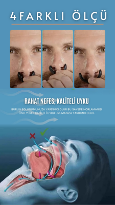 Mıknatıslı Burun Bandı 4’lü Set – Horlama Azaltıcı - 2